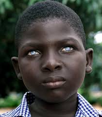 blue eyes black people