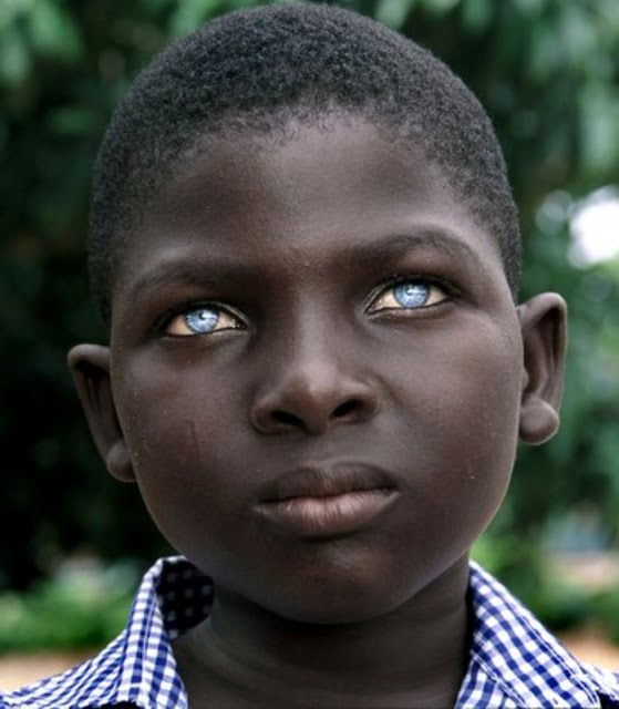 black boy blue eyes